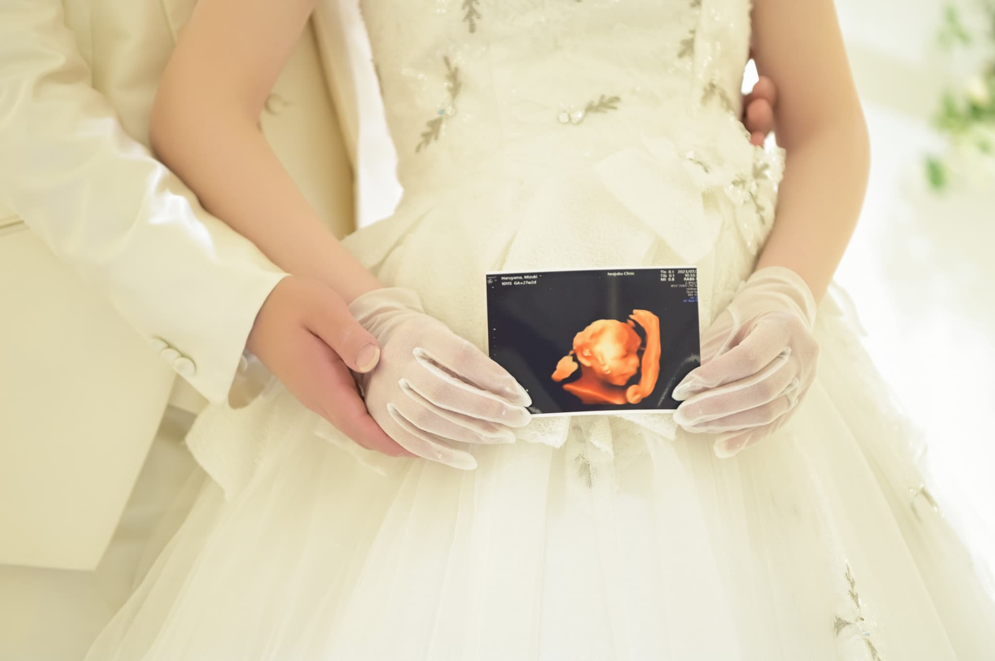 お腹のお子様と一緒に！マタニティウェディングの魅力♪
