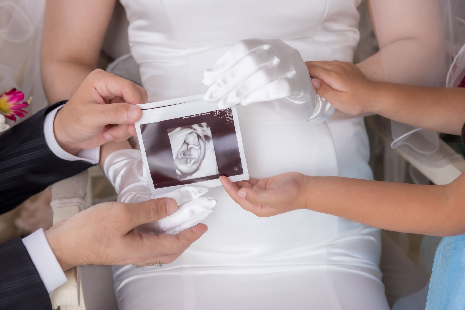 小さな結婚式 宮崎スタジオ