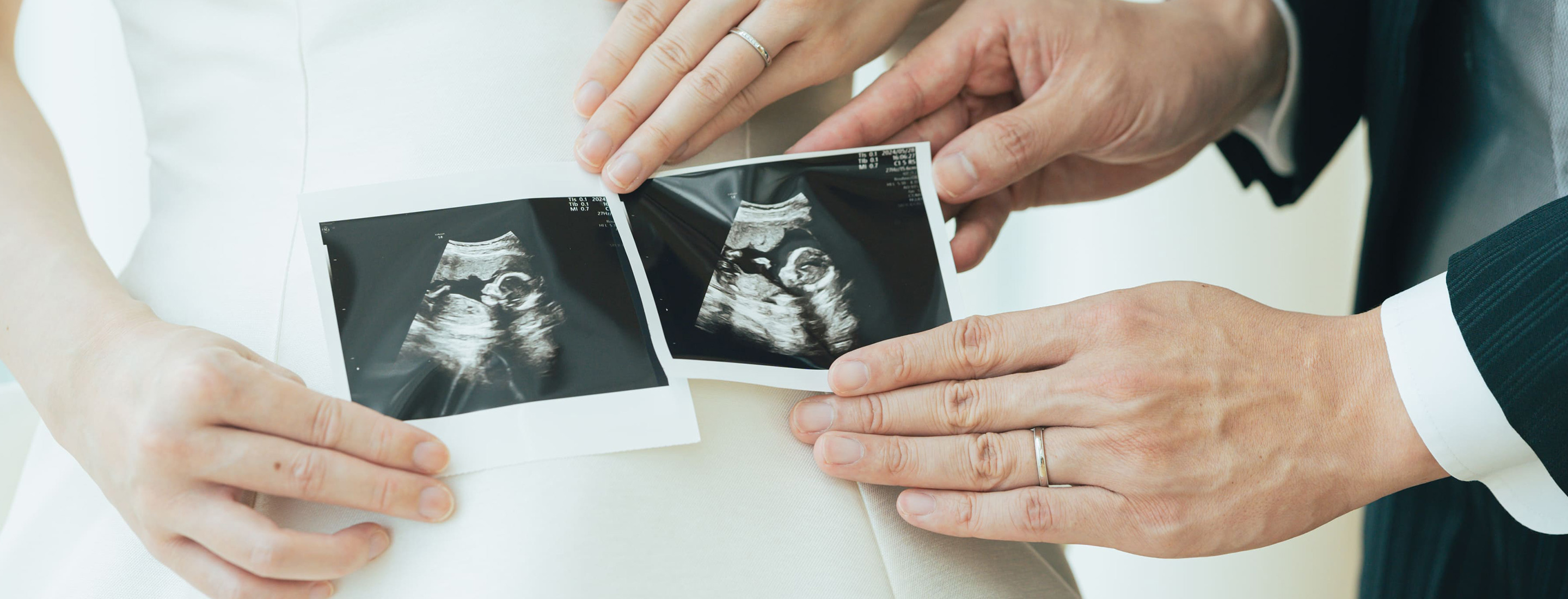 全国の結婚式場・披露宴会場 メインビジュアル